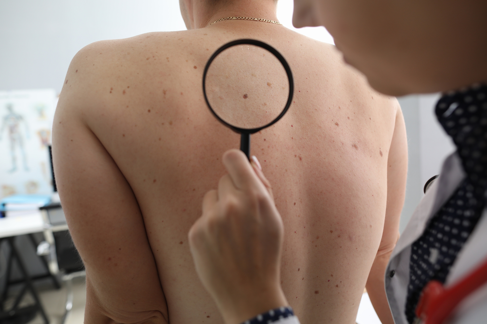 Dermatology Appointment at Clinic